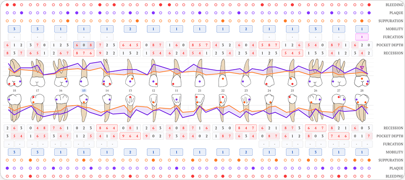 Periodontal chart