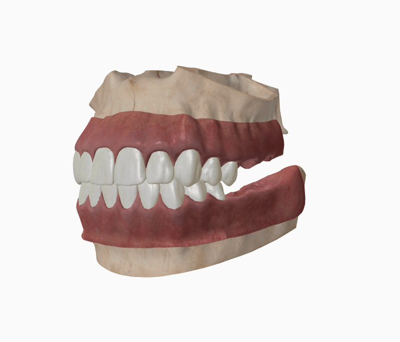 Child 3D jaw