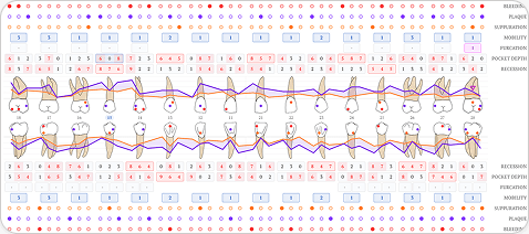 Periodontal chart